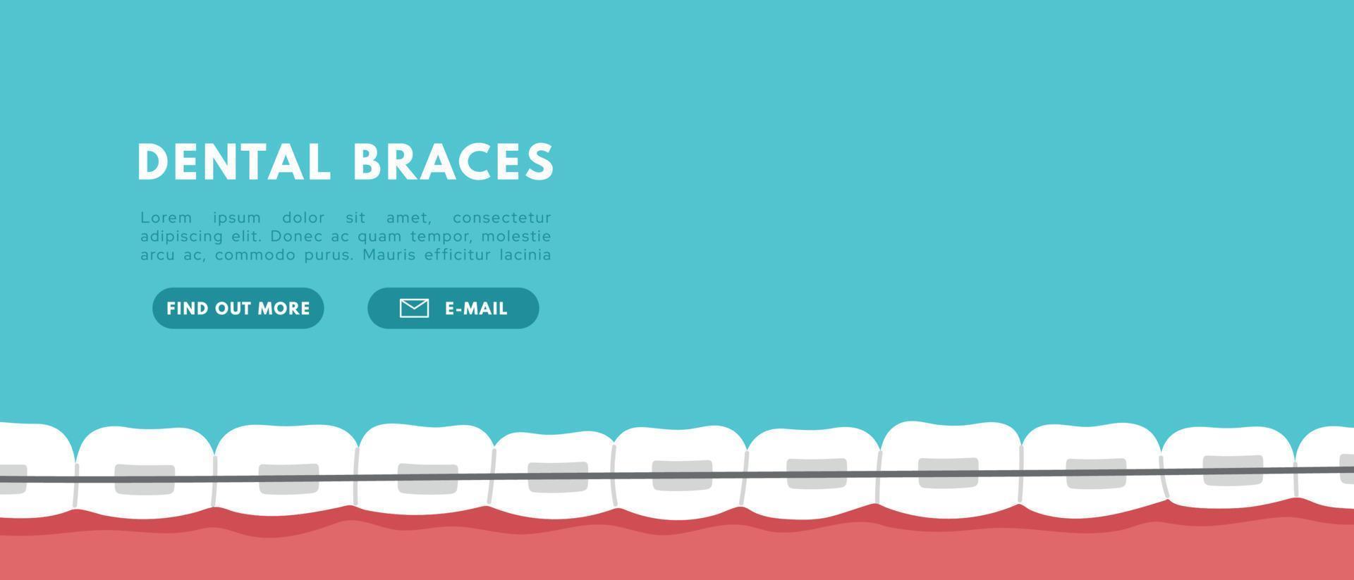 bannière d'accolades de dents. problème d'orthodontie, sourire avec brackets, retenue. illustration de vecteur plat isolé