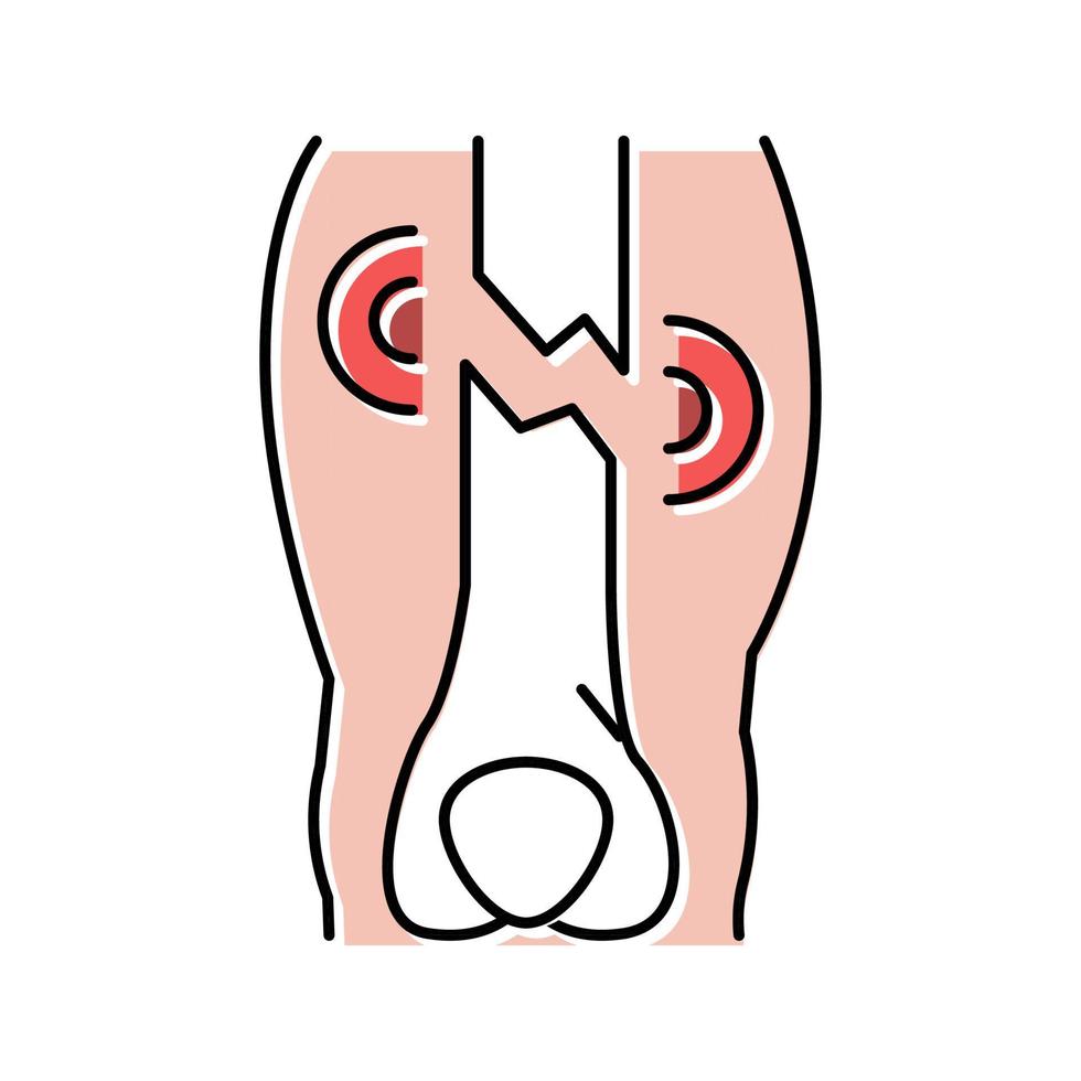 illustration vectorielle d'icône de couleur de maladie de fracture de membre fermé vecteur