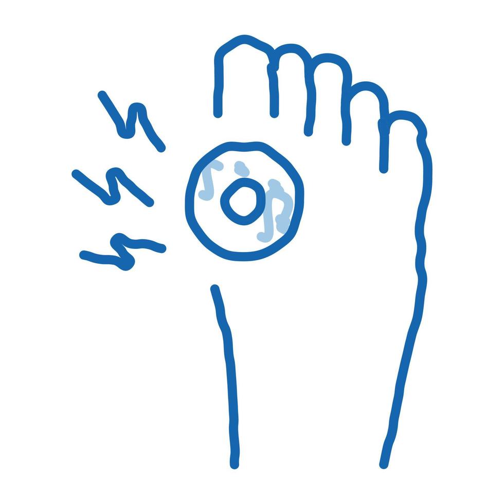 arthrite de l'os sur pied doodle icône illustration dessinée à la main vecteur