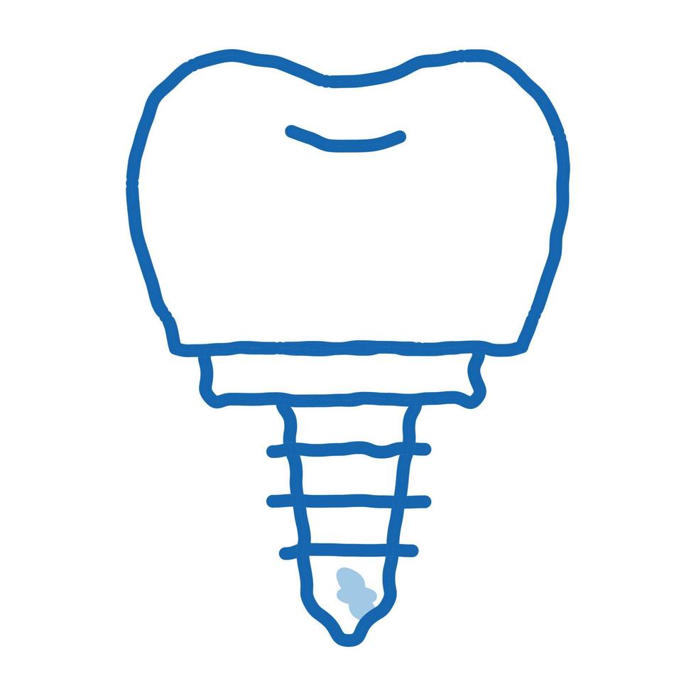 dentiste stomatologie implant dentaire doodle icône illustration dessinée à la main vecteur