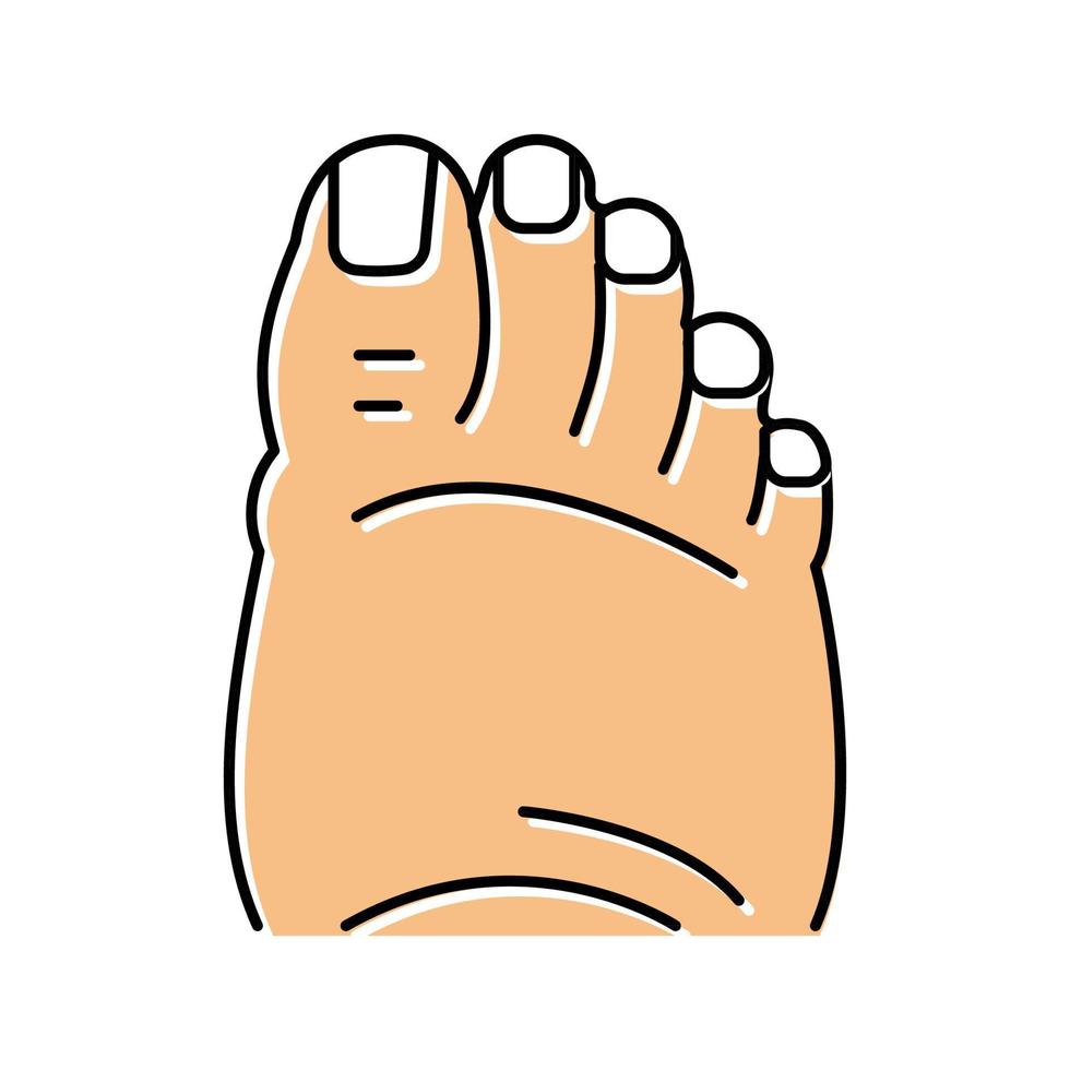 illustration vectorielle de l'icône de couleur de l'œdème du pied gras vecteur