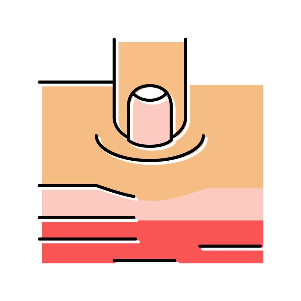 œdème piquant sur l'illustration vectorielle de l'icône de couleur de la jambe du patient vecteur