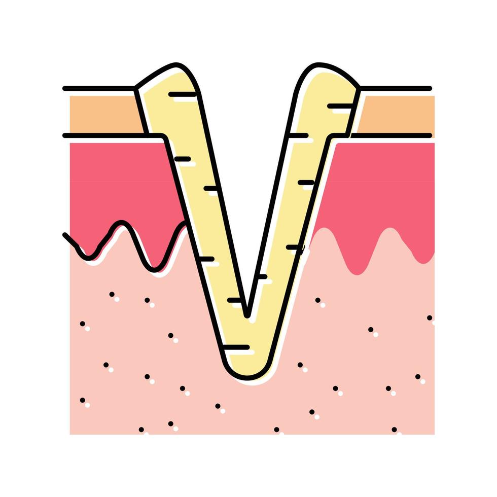 pic à glace icône de couleur de cicatrice d'acné illustration vectorielle vecteur