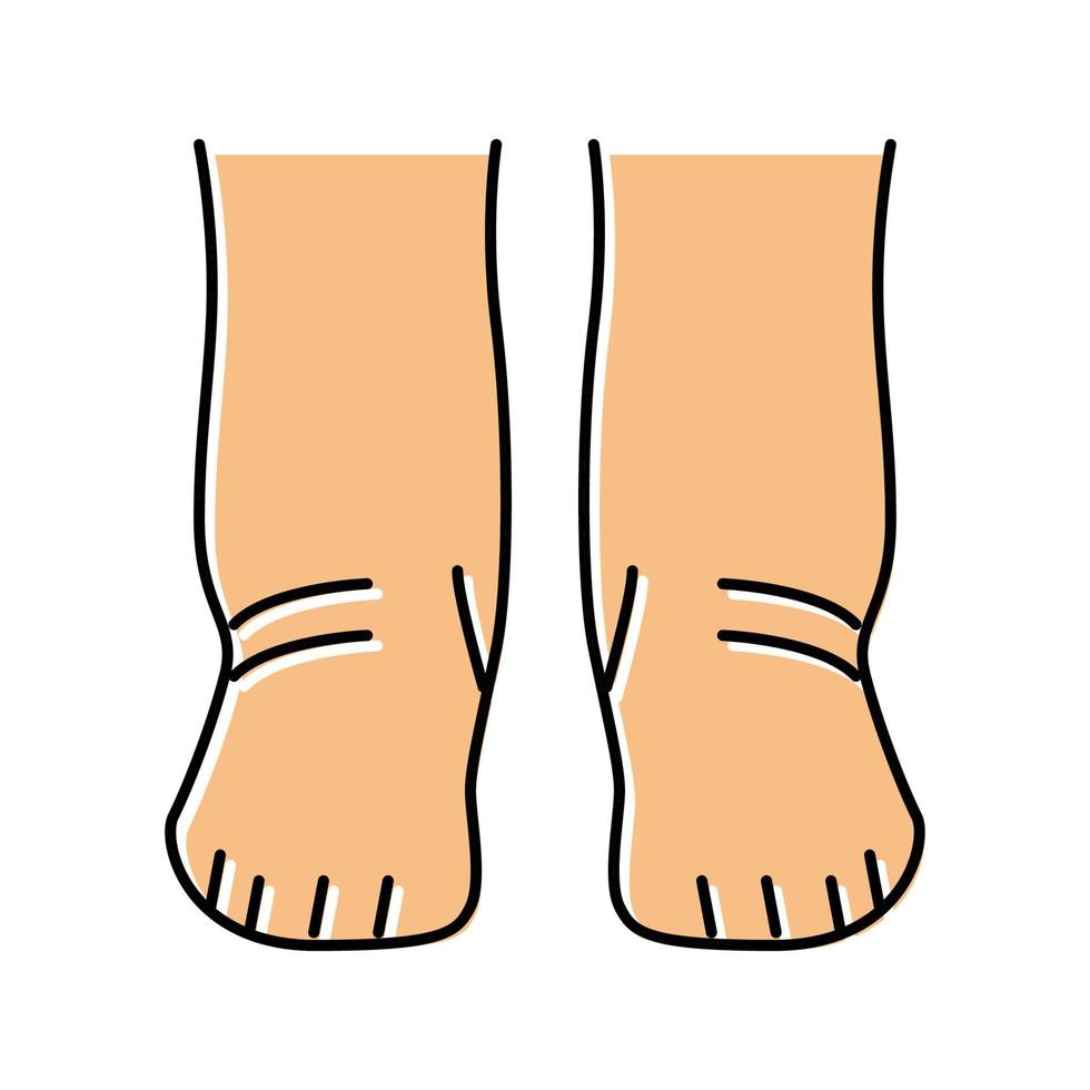 pieds oedème santé maladie couleur icône illustration vectorielle vecteur