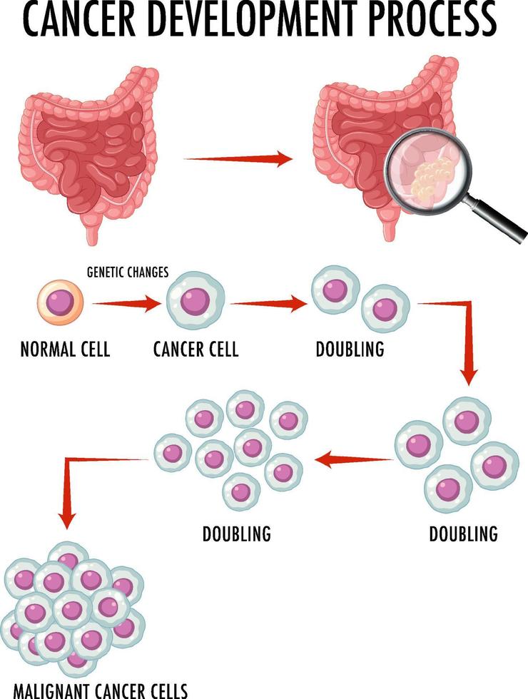 diagramme montrant les cellules normales et cancéreuses chez l'homme vecteur