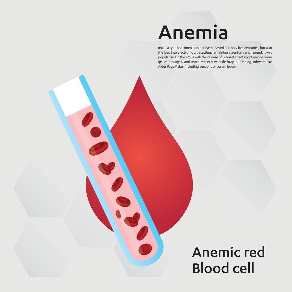 anémie quantité de sang rouge carence en fer anémie différence de la quantité d'anémie de globules rouges et symptômes normaux illustration vectorielle médical. vecteur