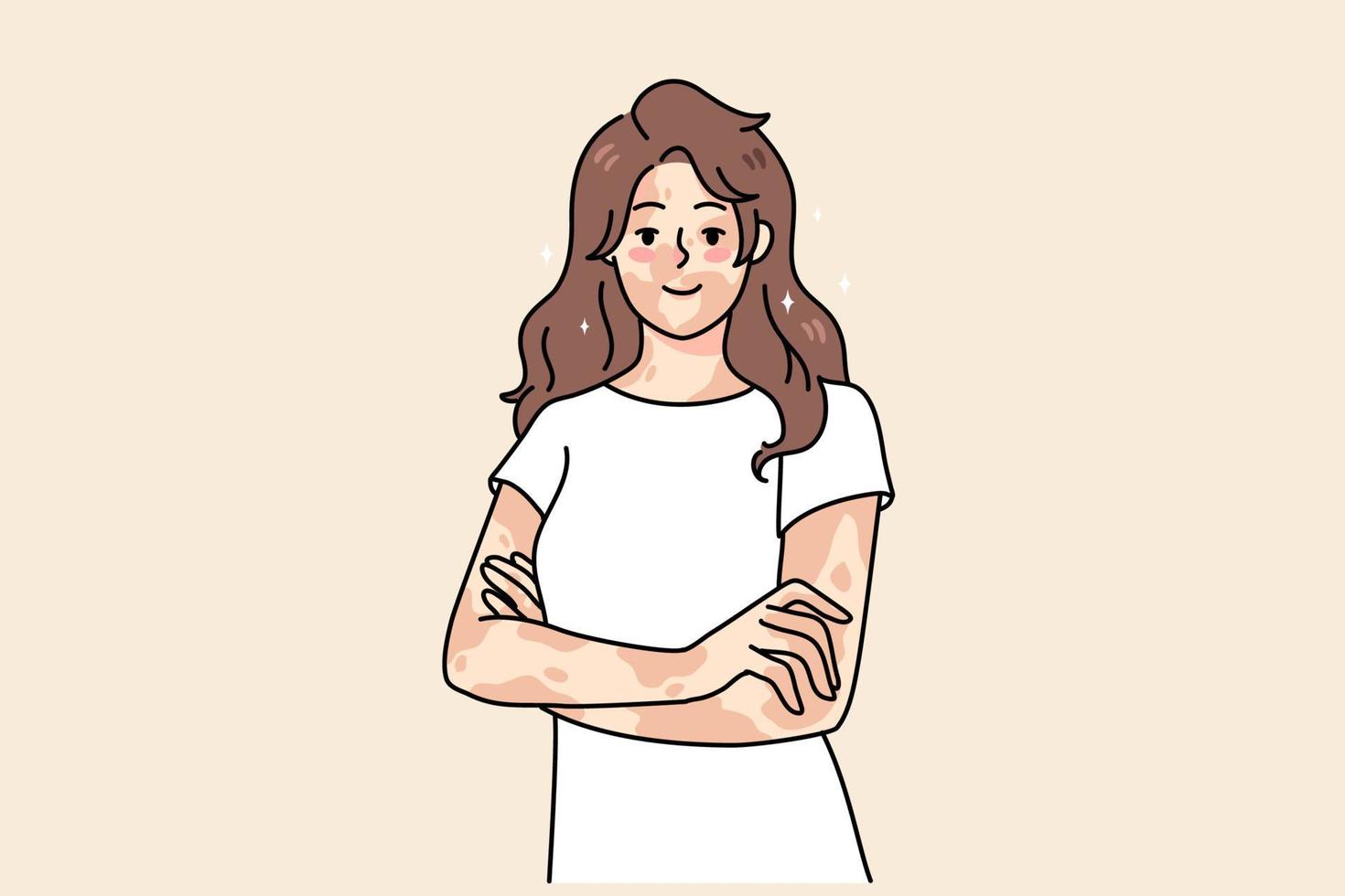 souriant Jeune femme avec peau maladie ressentir corps positif. content fille sur vitiligo international journée. dépigmentation journée. soin de la peau problème concept. plat vecteur illustration.