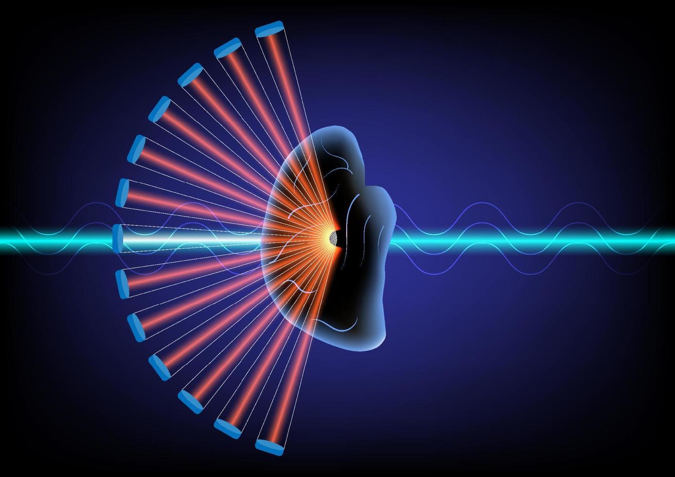 concentrer ultrason pour traitement de neurologique maladie. vecteur