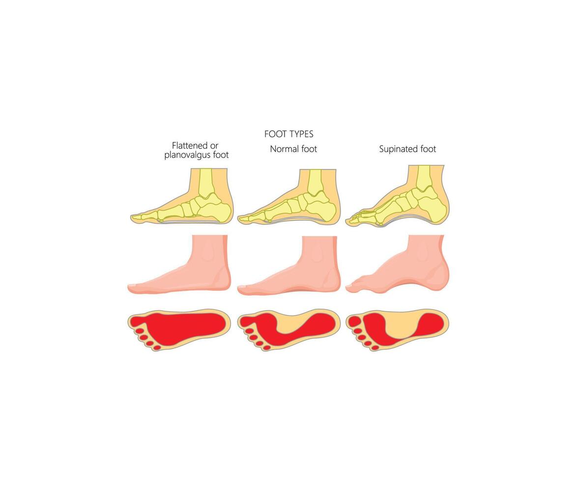 pied les types nourriture médical pied vecteur