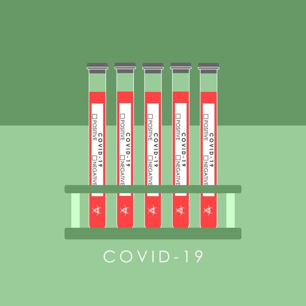 tests de laboratoire pour détecter le coronavirus dans le vecteur