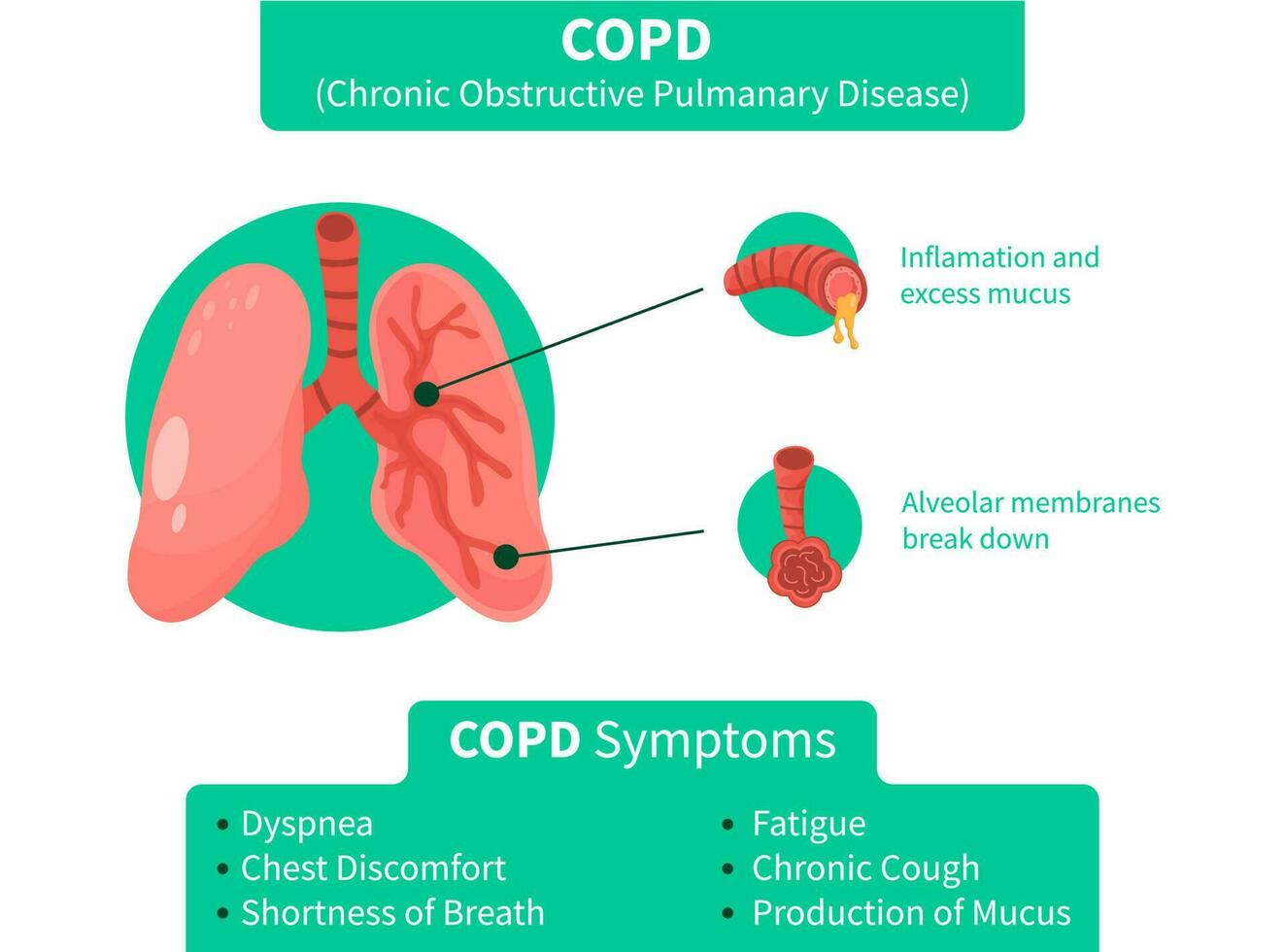 Humain poumons vecteur agrafe art icône. copd vecteur illustration, chronique obstructif pulmonaire explication