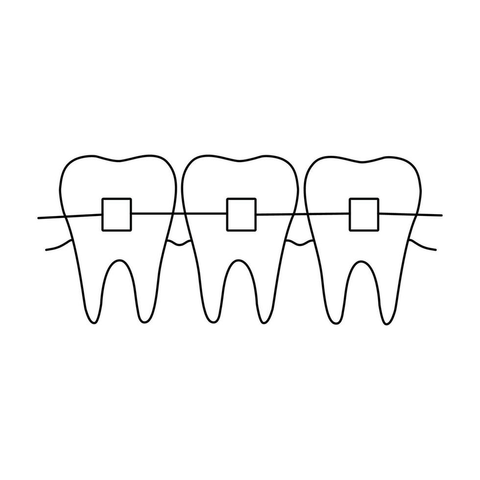 dent un appareil dentaire contour griffonnage icône. dentisterie, stomatologie et dentaire se soucier concept. vecteur main tiré esquisser isolé sur blanc Contexte. Trois les dents avec un appareil dentaire