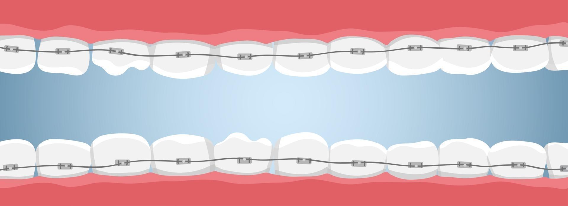 bannière avec dents et accolades vecteur