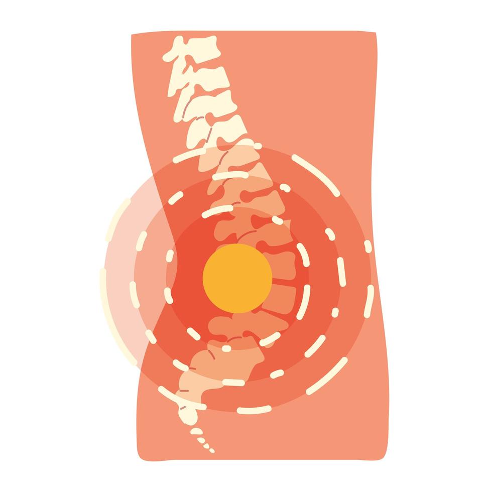 arthrite mal de dos vecteur