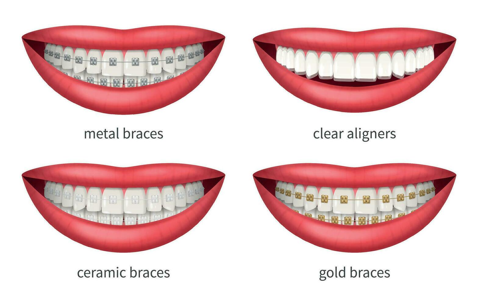 les dents un appareil dentaire ensemble vecteur