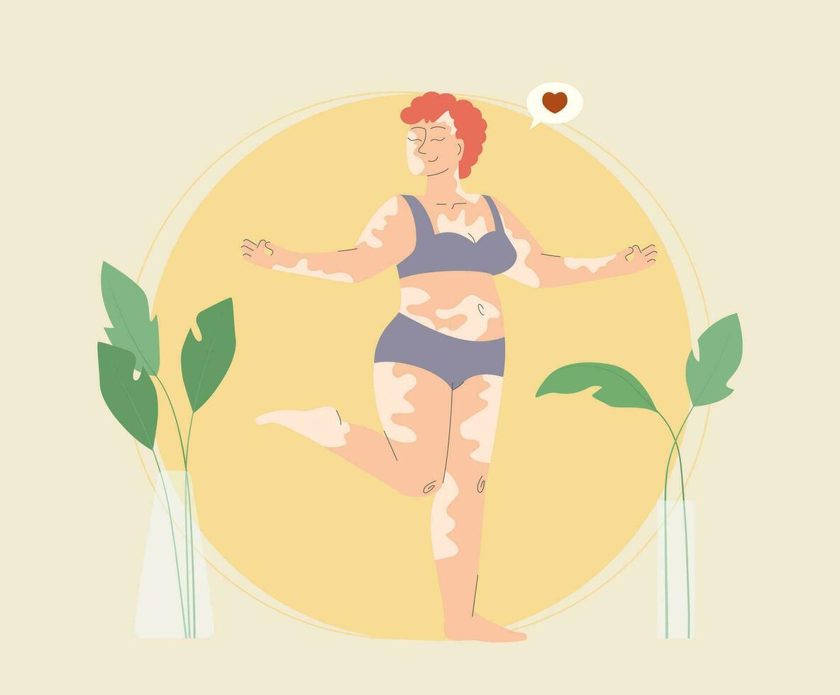 content dodu femme avec vitiligo à la recherche dans miroir vecteur illustration