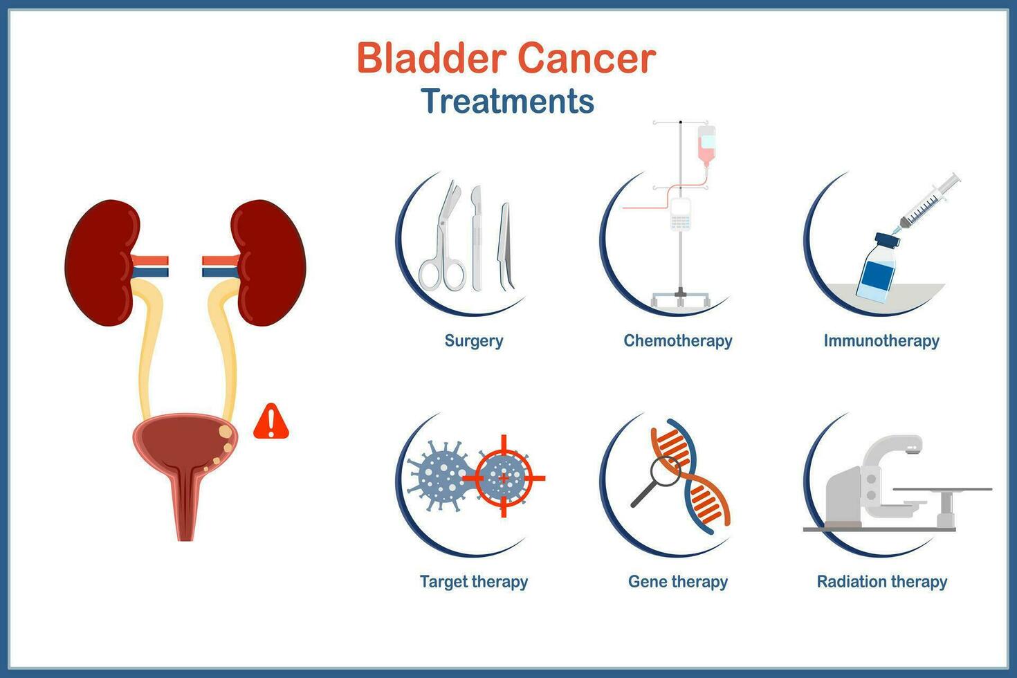 vecteur médical illustration dans plat style, vessie cancer traitement infographie.chirurgie,chimiothérapie, immunothérapie ciblée thérapie, gène thérapie, rayonnement thérapie.infographie de santé se soucier concept