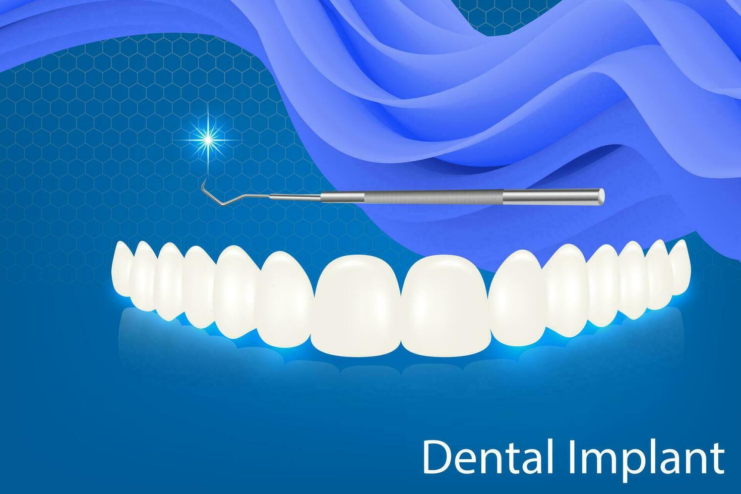 Humain les dents et dentaire implant vecteur illustration.