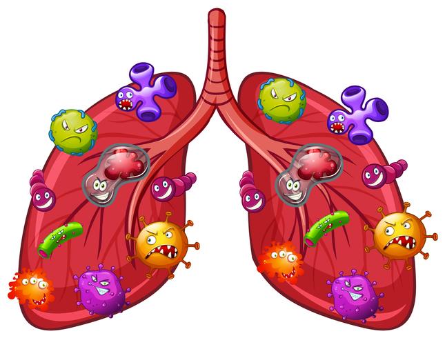 Un vecteur de bactéries pulmonaires