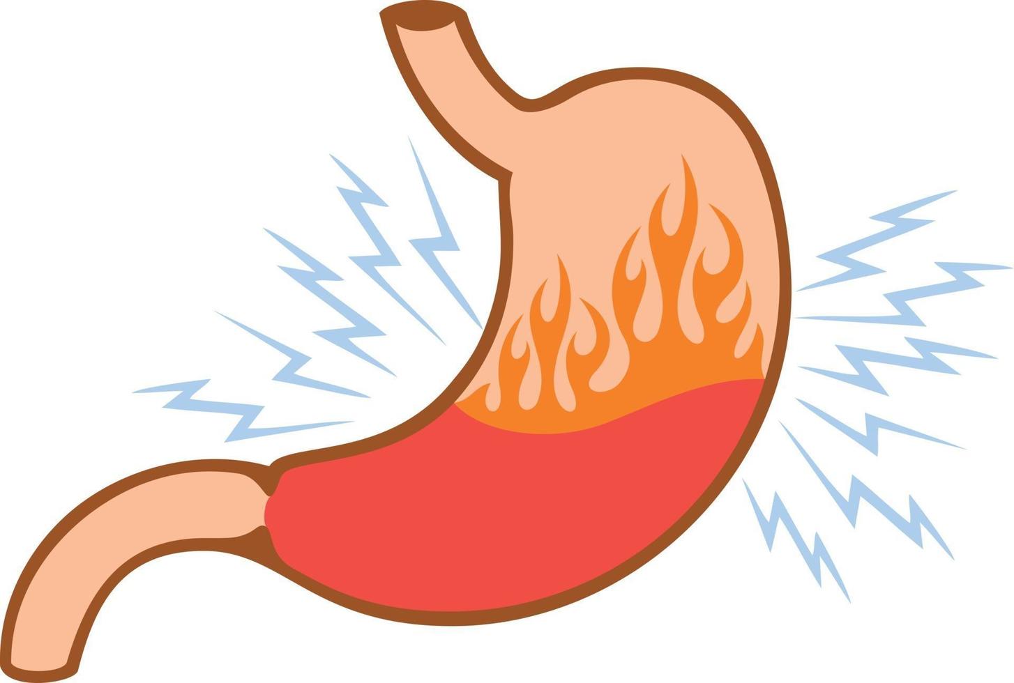 problème de brûlures d'estomac internes à l'estomac humain vecteur