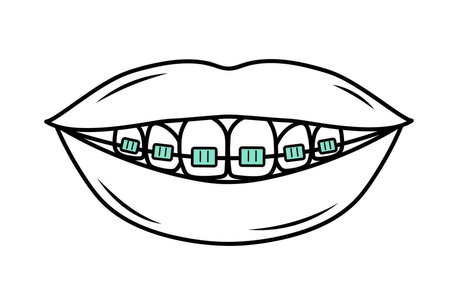 Humain bouche avec les dents dans un appareil dentaire dans griffonnage style. correctif orthodontie. dentaire se soucier. linéaire vecteur illustration.