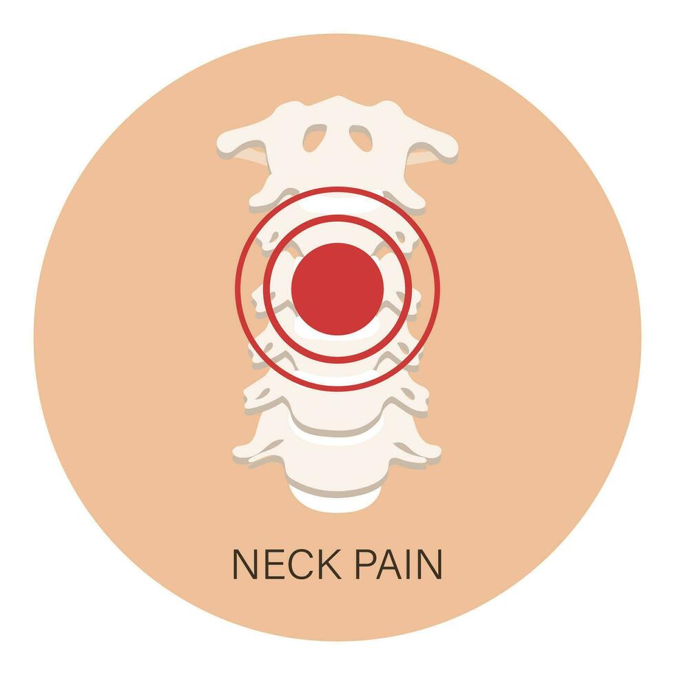 douleur dans le cervical vertèbres, l'arthrose, rhumatoïde arthrite. anatomie de Humain os. illustration, vecteur