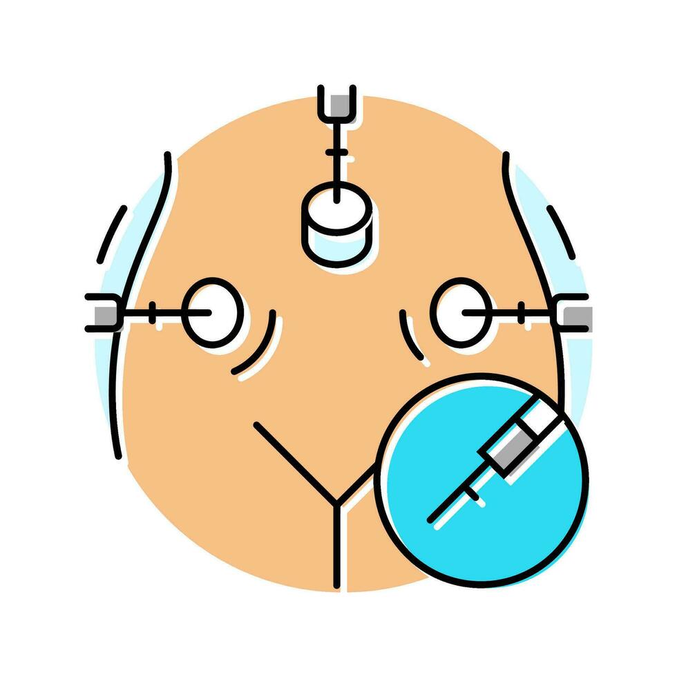 laparoscopique chirurgie Couleur icône vecteur illustration