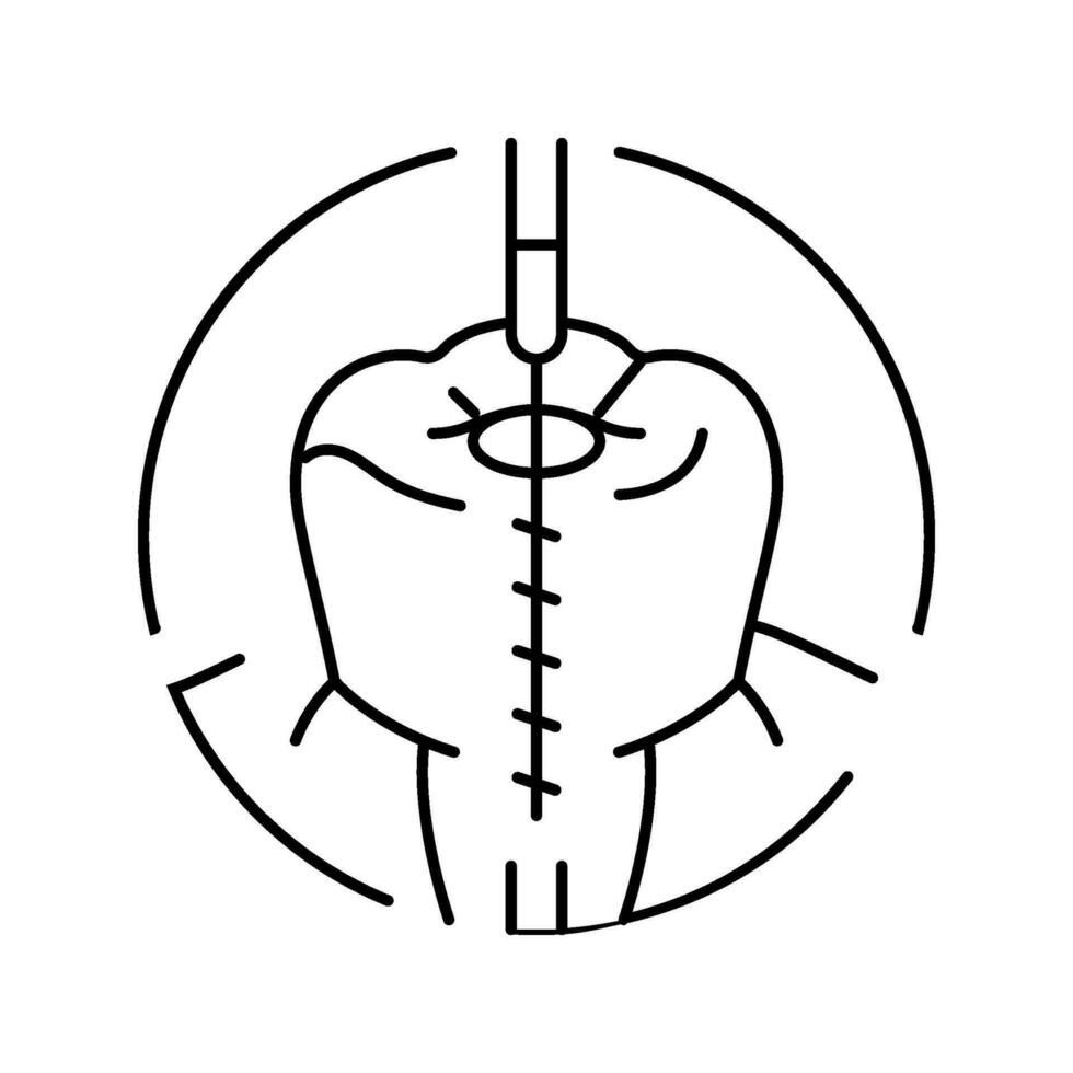 illustration vectorielle de l'icône de la ligne de traitement du canal radiculaire vecteur