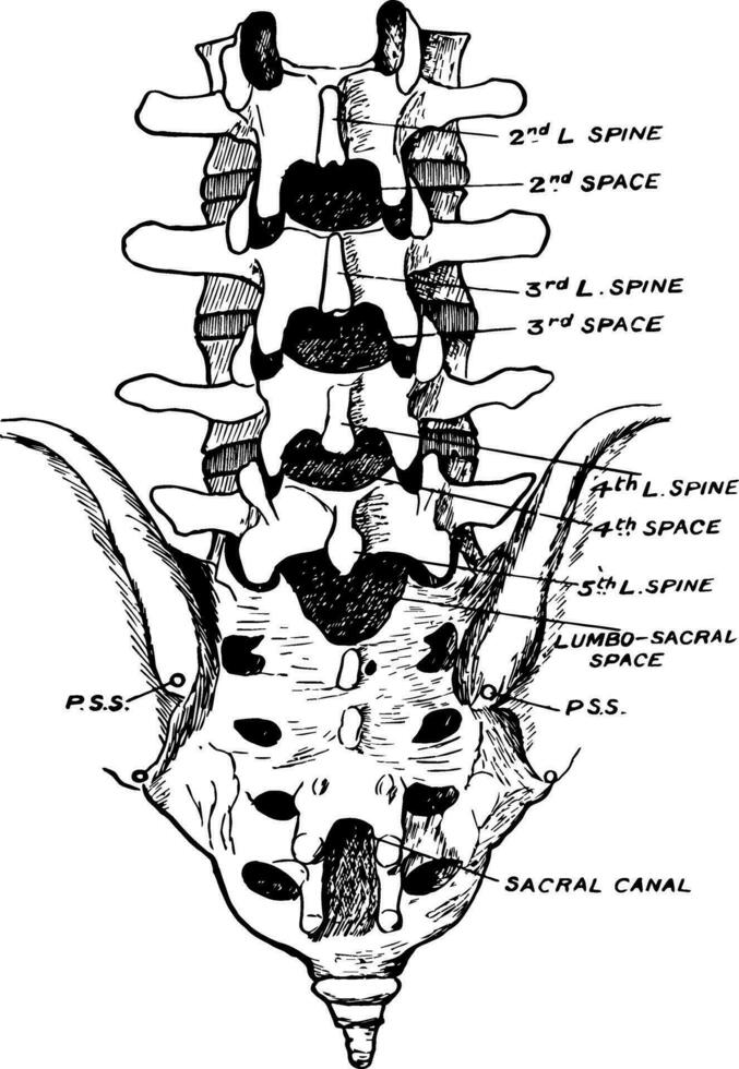 lombaire montrant position de Quatrième lombaire colonne vertébrale, ancien illustration. vecteur