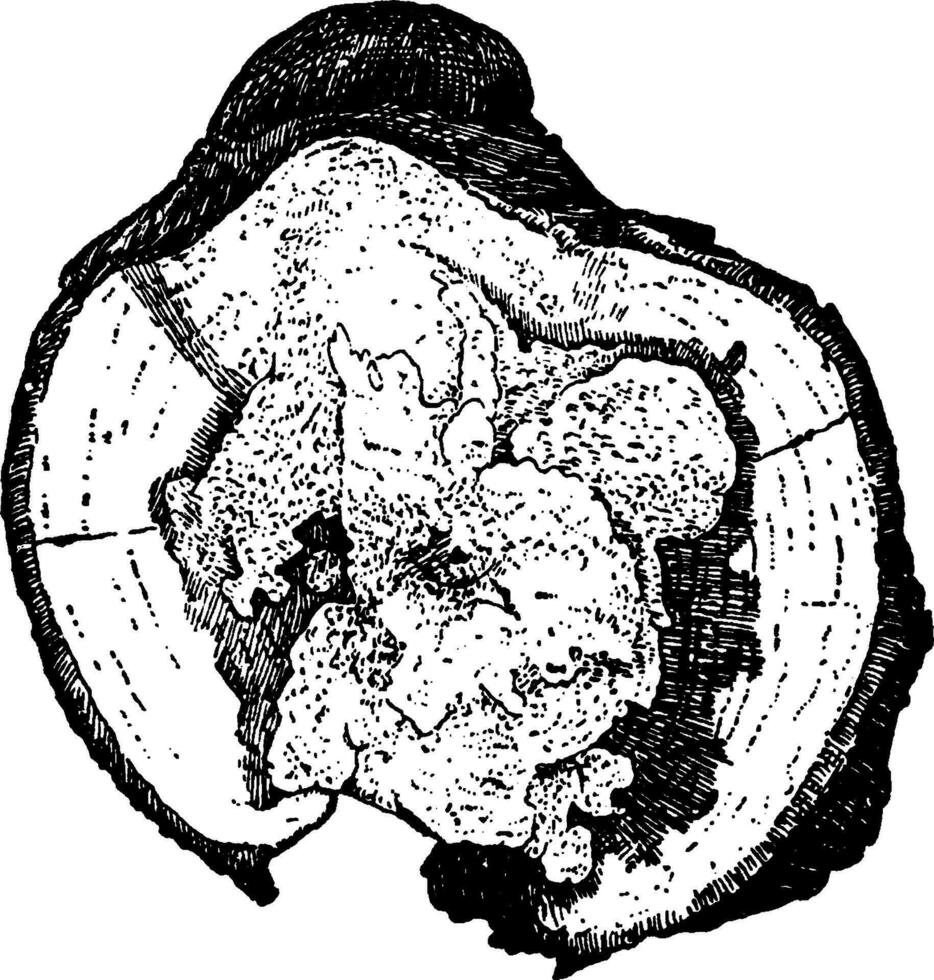 fomes igniaire infecté érable membre ancien illustration. vecteur