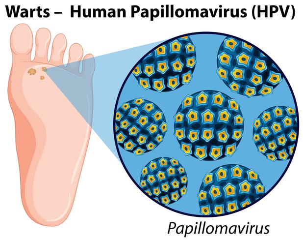 Diagramme montrant le papillomavirus humain vecteur