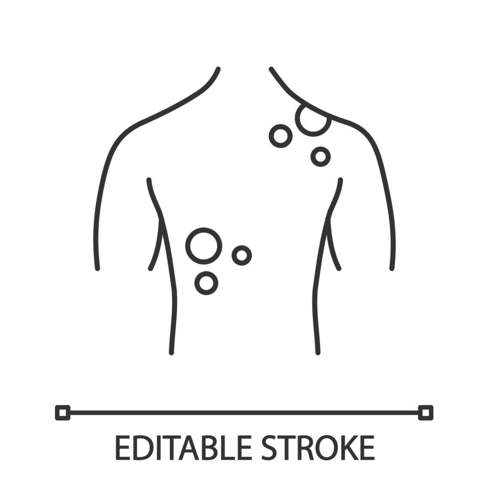 icône linéaire de cancer de la peau. illustration de la ligne mince. maladies dermatologiques. éruption cutanée, taches sur le dos. mélanome. symbole de contour. dessin de contour isolé de vecteur. trait modifiable vecteur