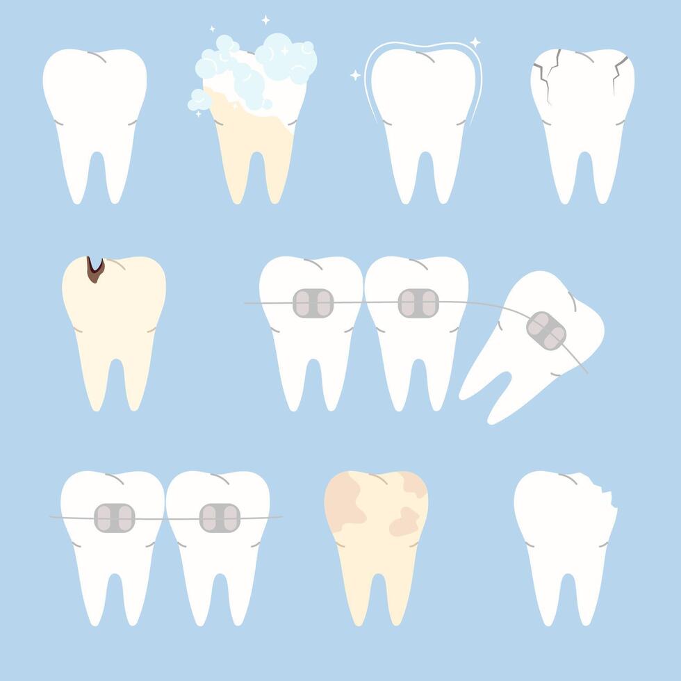 ensemble de dents. en bonne santé et malade dent, carie, cassé, taches, fissure, orthodontique croisillons. plat vecteur illustration