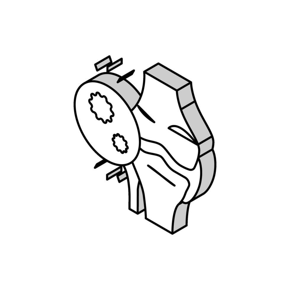 infectieux arthrite isométrique icône vecteur illustration
