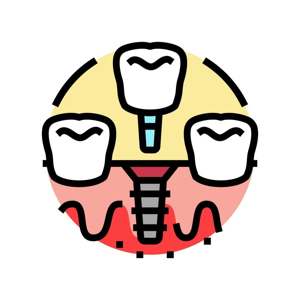 dentaire implant chirurgie chirurgie Couleur icône vecteur illustration