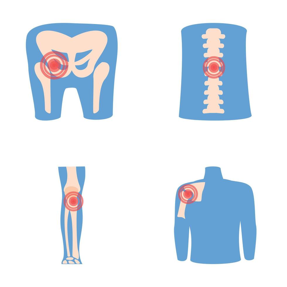 rhumatisme Icônes ensemble dessin animé vecteur. Humain mixte avec douleur bague vecteur