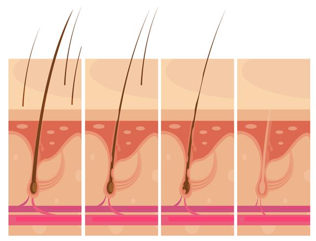 Concept de peau de perte de cheveux vecteur
