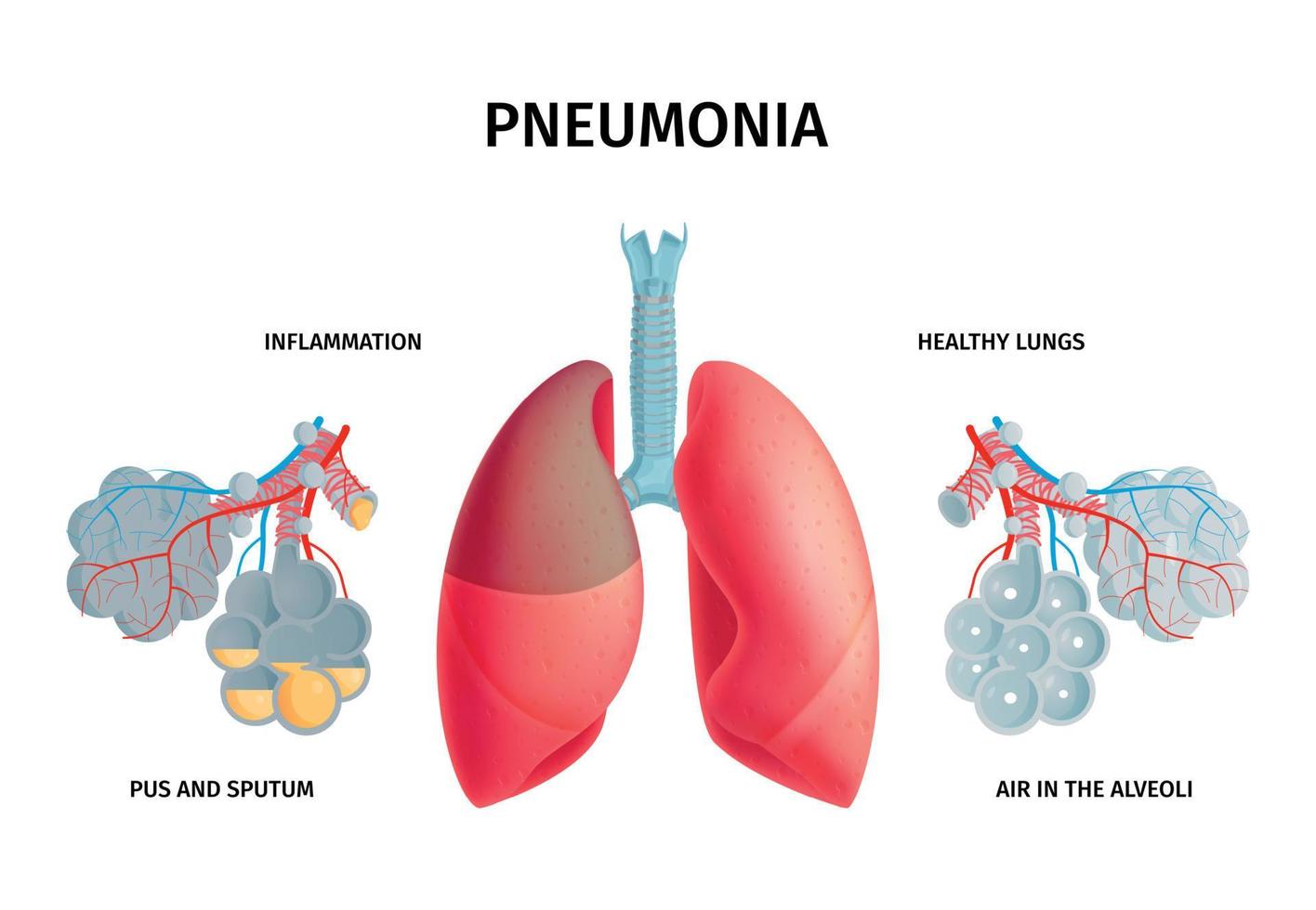 infochart sur l'anatomie du poumon humain vecteur