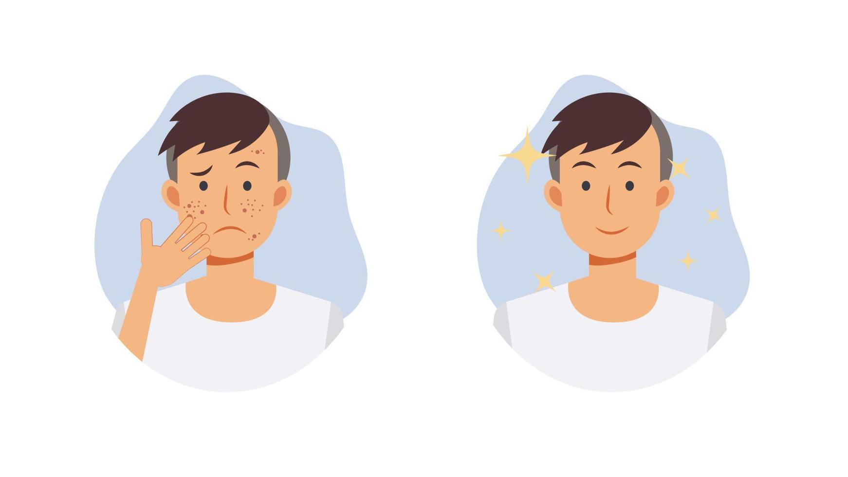 concept de soins de la peau. avant et après la procédure de traitement de l'acné. un homme ayant un problème d'acné. illustration de personnage de dessin animé de vecteur plat.