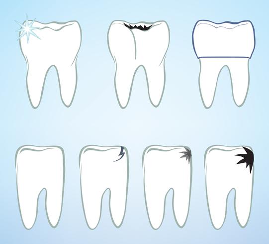 Ensemble de dents. Signe de dents blanches. Collection médicale isolée dentaire. vecteur