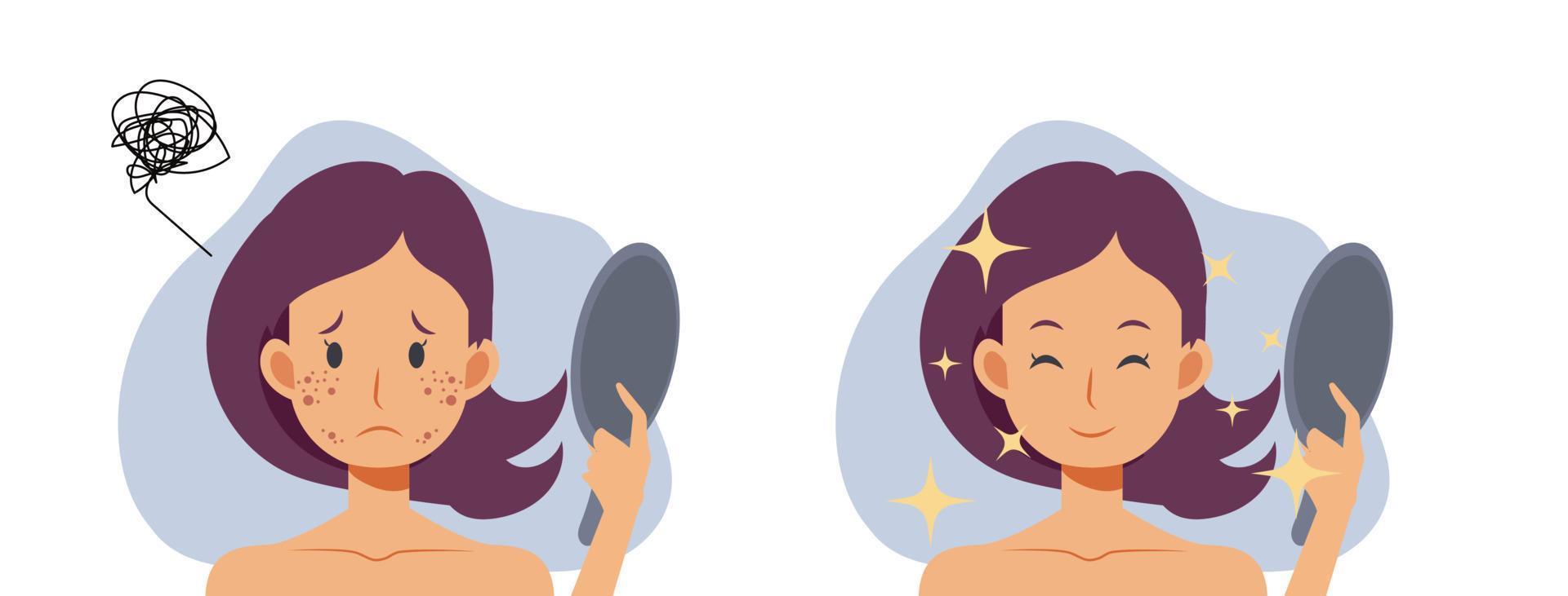concept de soins de la peau. femme, fille avec acne.before et après acne.flat vector 2d cartoob caractère illustration.