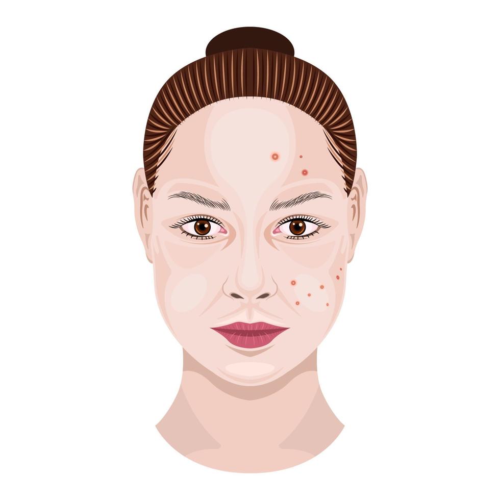 femme visage traitement acné isolé fond blanc vecteur