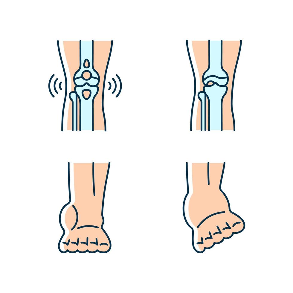 ensemble d'icônes de couleur rvb douleur à la jambe arthritique. maladie dégénérative des articulations. condition de bursite. tensions musculaires. ligaments de la cheville foulés. illustrations vectorielles isolées. collection de dessins au trait remplis simples vecteur