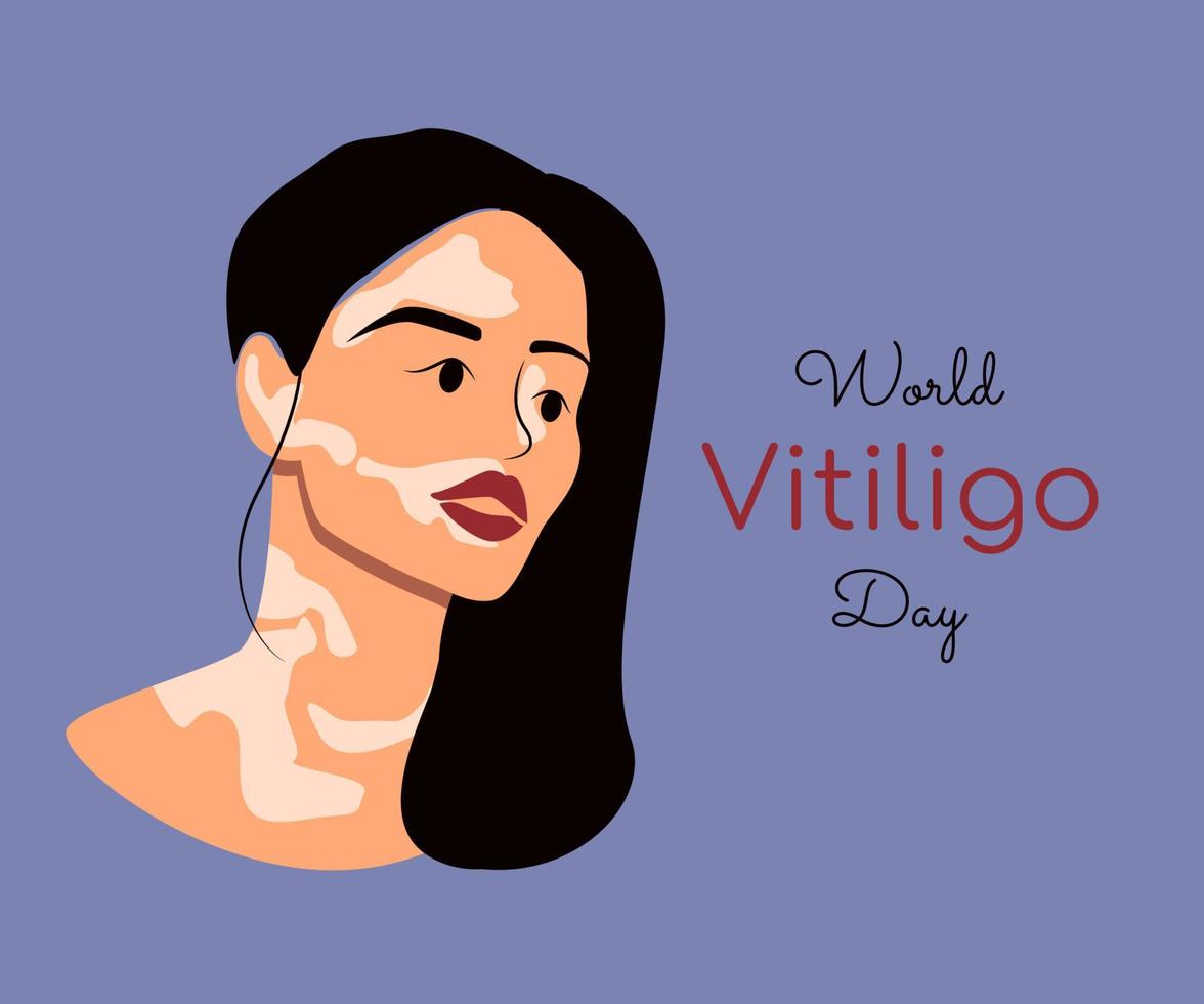 jeune femme afro-américaine vit avec le vitiligo. beauté différente, amour de soi et concept de maladie de la peau. journée mondiale du vitiligo. illustration de vecteur plat isolé sur fond beige