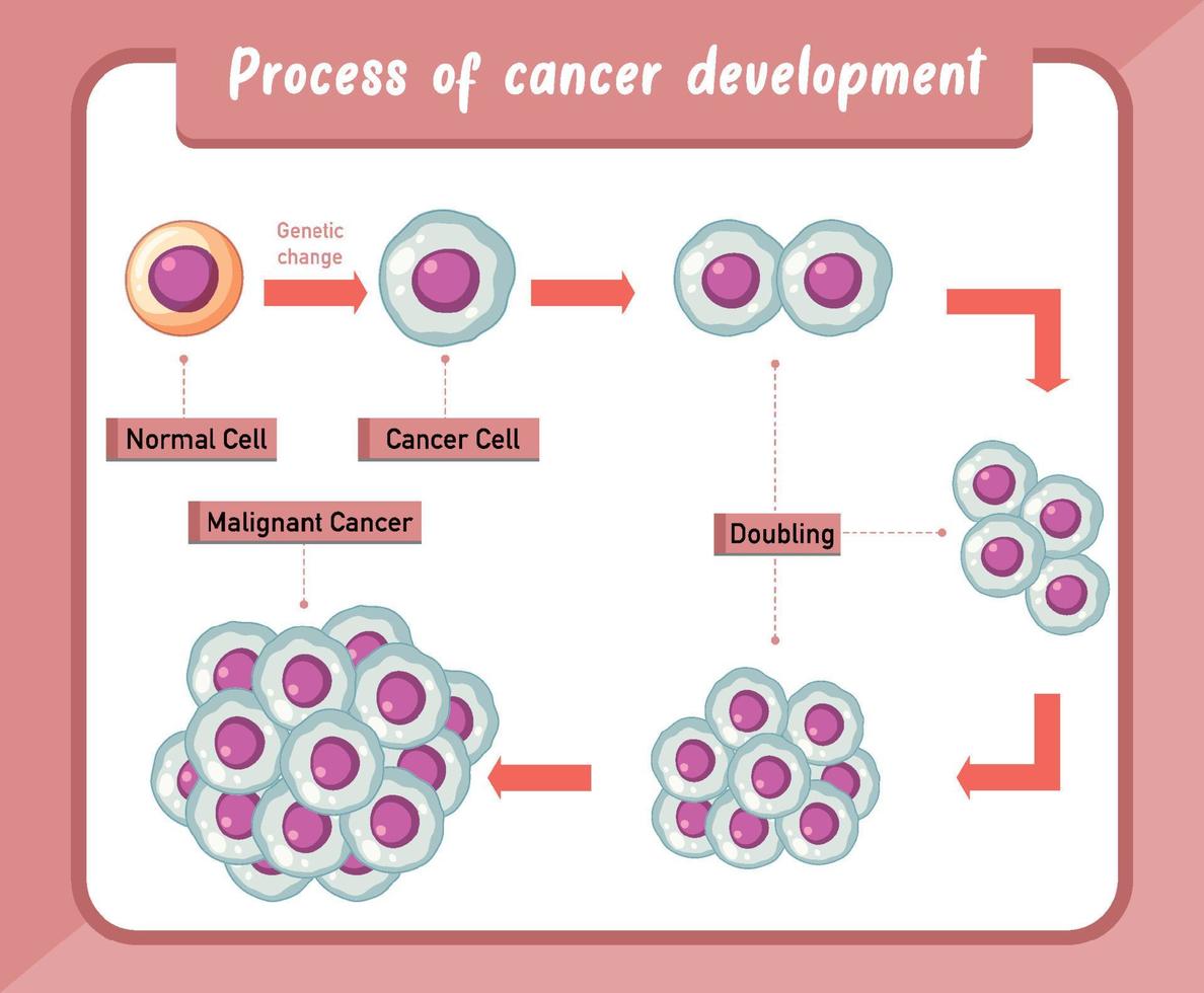 infographie sur le processus de développement du cancer vecteur