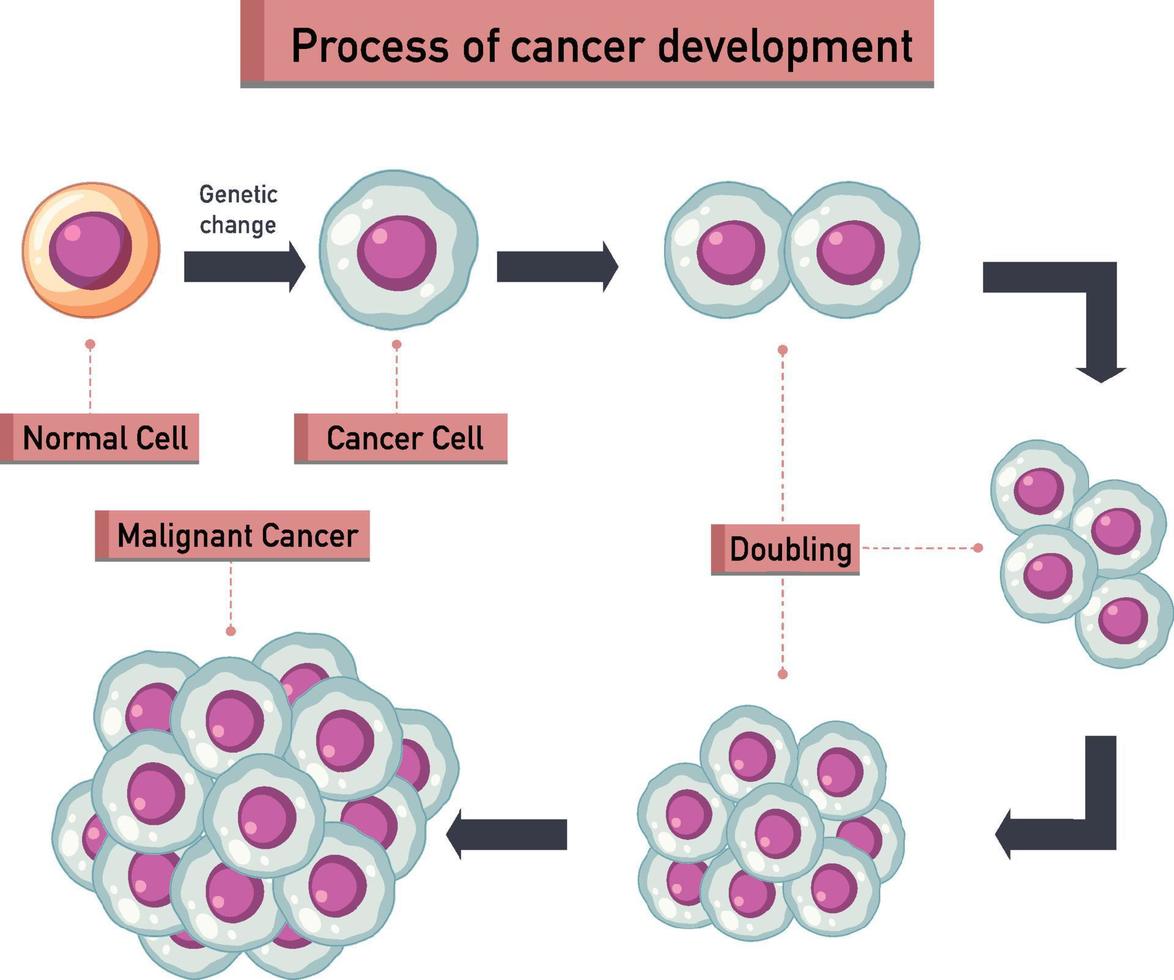 infographie sur le processus de développement du cancer vecteur