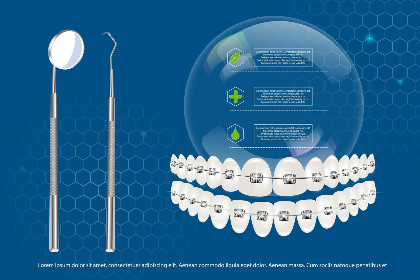 Illustration vectorielle 3d, dents réalistes avec accolades de mâchoire supérieure et inférieure sur fond d'infographie et d'outils. alignement de la morsure des dents, dentition avec accolades, accolades dentaires. vecteur
