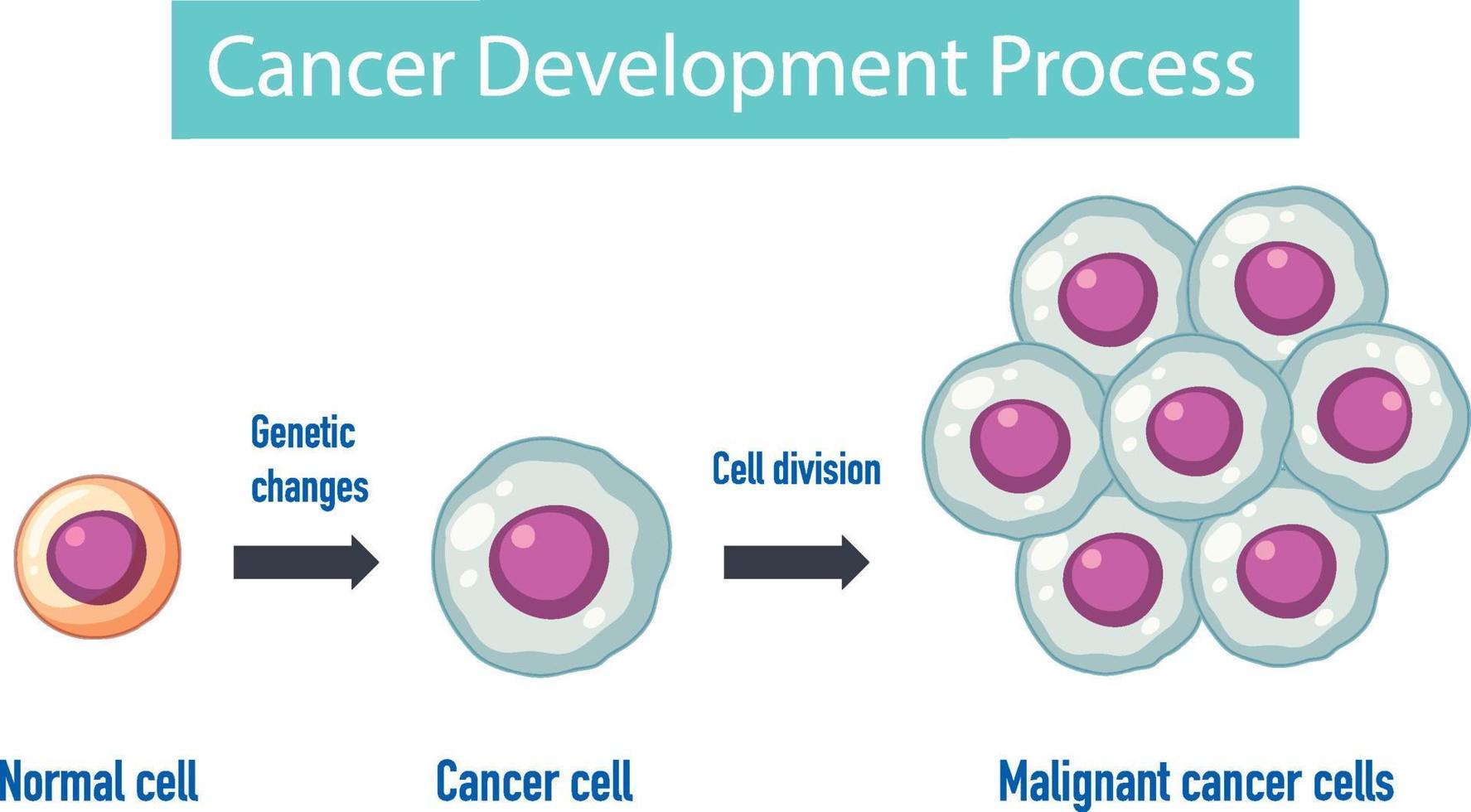 infographie sur le processus de développement du cancer vecteur