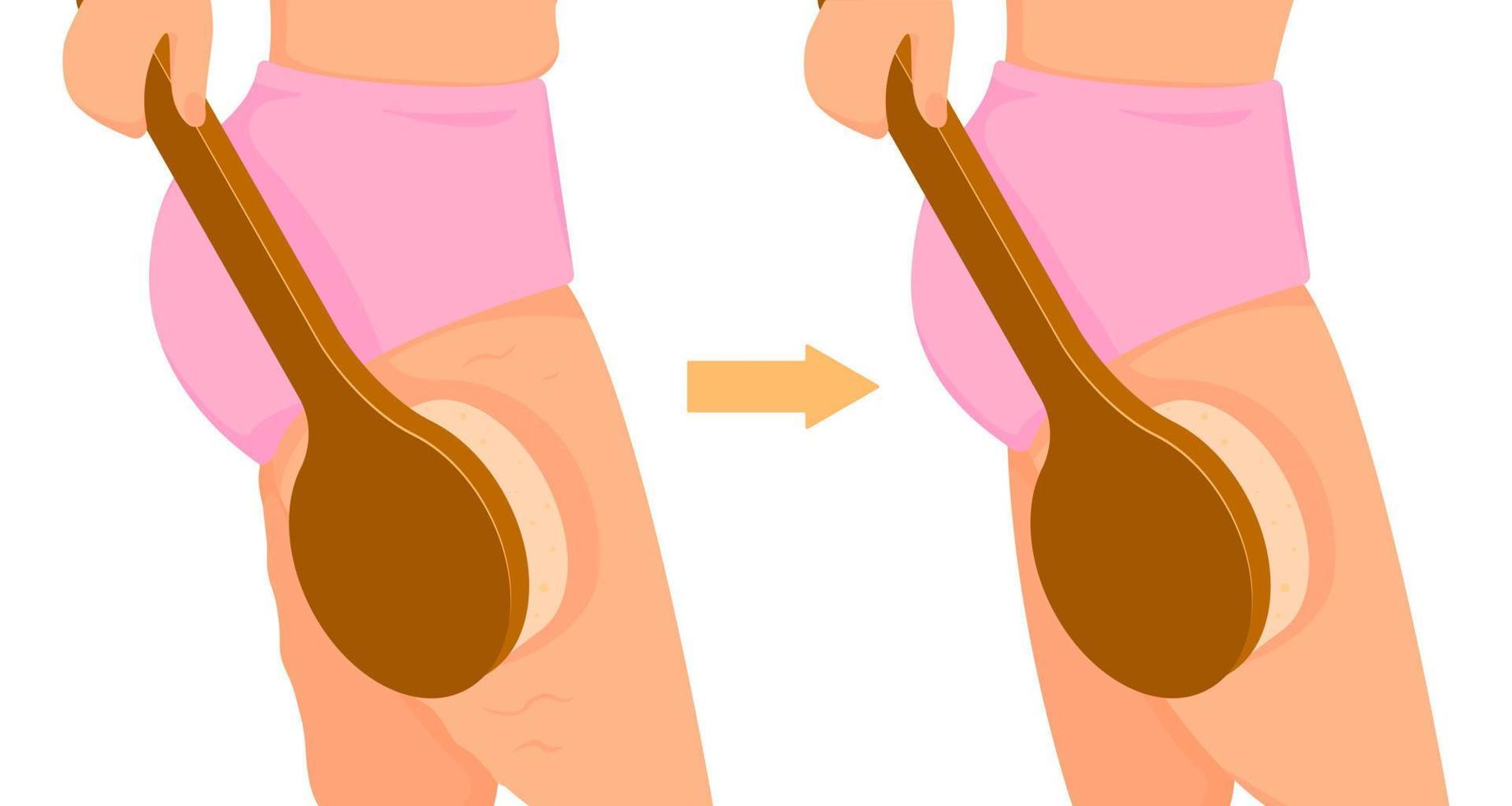 massage anti-cellulite à la brosse. brossage à sec pour se débarrasser de la cellulite sur les cuisses. concept de soins du corps et de beauté. vecteur