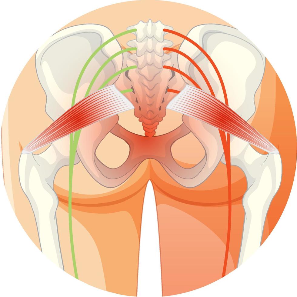 bas du dos souffrant de spondylarthrite ankylosante vecteur